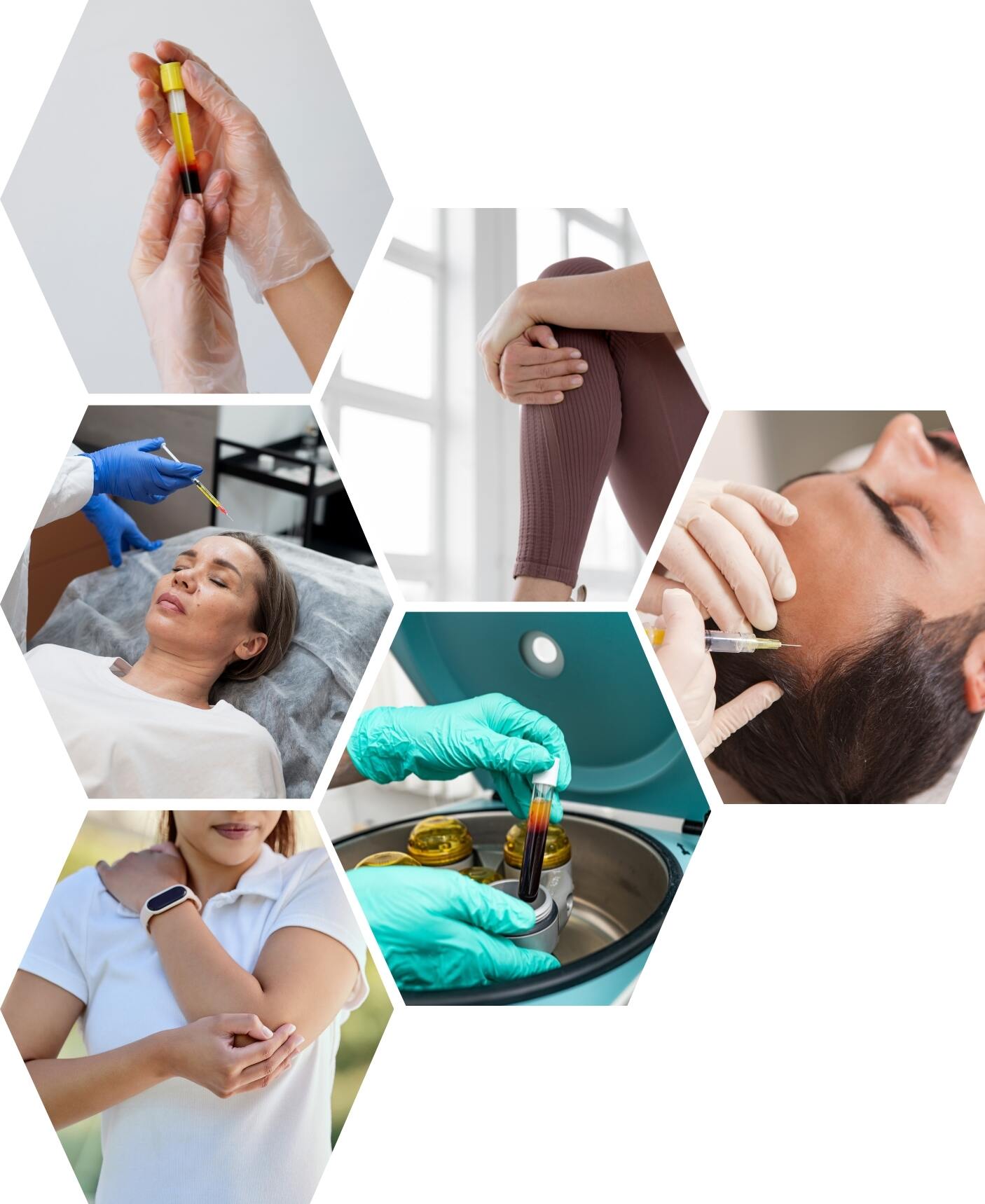 Platelet-Rich Plasma (PRP) Therapy