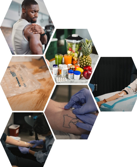 IV Therapy for Pain Relief